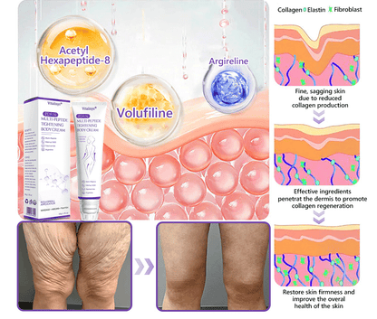 💎Vitalisys® PDRN Multi-Peptide Massaging Body Roller Cream- Anti-aging, Hydrating, Skin Firming & Lifting, Skin Repair, Even Tone, Acne and Dark Spot Treatment, Wart and Mole Removal, and Psoriasis Relief.