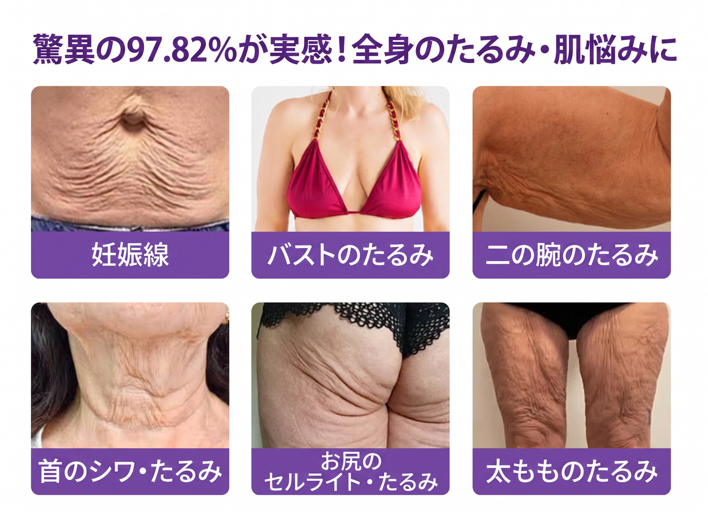 Vitalisys®💎PDRNマルチペプチド マッサージボディローラークリーム — エイジングケア・保湿・肌引き締め＆リフトケア・肌修復・肌トーン均一化・ニキビやシミケア・イボやほくろケア・乾癬による肌トラブルの緩和をサポート —