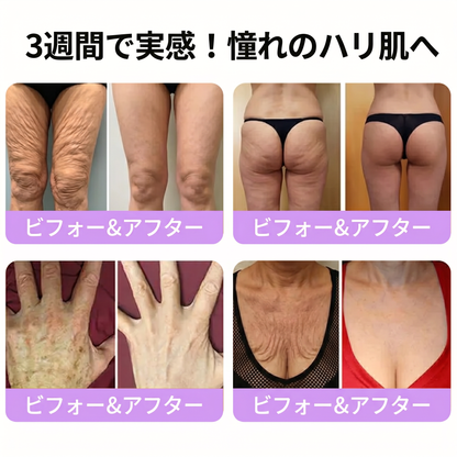 Vitalisys®💎PDRNマルチペプチド マッサージボディローラークリーム — エイジングケア・保湿・肌引き締め＆リフトケア・肌修復・肌トーン均一化・ニキビやシミケア・イボやほくろケア・乾癬による肌トラブルの緩和をサポート —