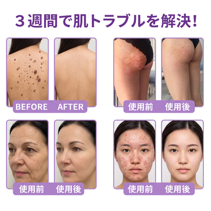 Vitalisys®💎PDRNマルチペプチド マッサージボディローラークリーム — エイジングケア・保湿・肌引き締め＆リフトケア・肌修復・肌トーン均一化・ニキビやシミケア・イボやほくろケア・乾癬による肌トラブルの緩和をサポート —
