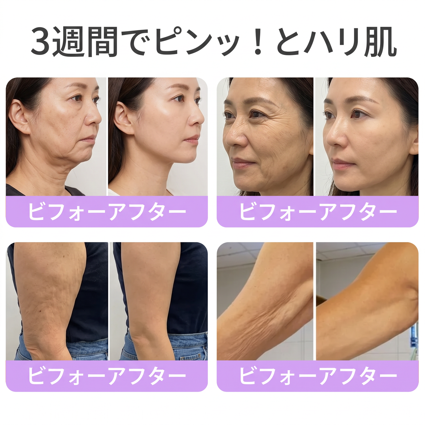 Vitalisys®💎PDRNマルチペプチド マッサージボディローラークリーム — エイジングケア・保湿・肌引き締め＆リフトケア・肌修復・肌トーン均一化・ニキビやシミケア・イボやほくろケア・乾癬による肌トラブルの緩和をサポート —