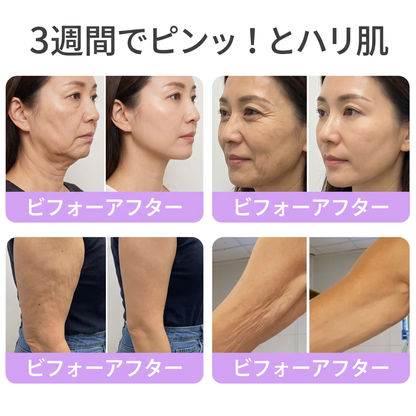 Vitalisys®💎PDRNマルチペプチド マッサージボディローラークリーム — エイジングケア・保湿・肌引き締め＆リフトケア・肌修復・肌トーン均一化・ニキビやシミケア・イボやほくろケア・乾癬による肌トラブルの緩和をサポート —