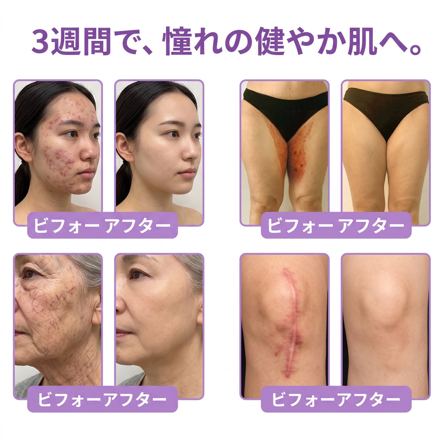 Vitalisys®💎PDRNマルチペプチド マッサージボディローラークリーム — エイジングケア・保湿・肌引き締め＆リフトケア・肌修復・肌トーン均一化・ニキビやシミケア・イボやほくろケア・乾癬による肌トラブルの緩和をサポート —