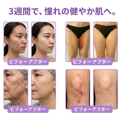 Vitalisys®💎PDRNマルチペプチド マッサージボディローラークリーム — エイジングケア・保湿・肌引き締め＆リフトケア・肌修復・肌トーン均一化・ニキビやシミケア・イボやほくろケア・乾癬による肌トラブルの緩和をサポート —