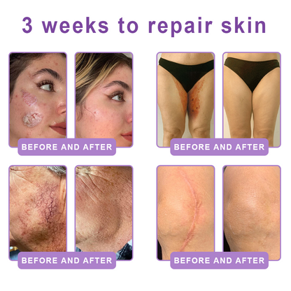 💎Vitalisys® PDRN Multi-Peptide Massaging Body Roller Cream- Anti-aging, Hydrating, Skin Firming & Lifting, Skin Repair, Even Tone, Acne and Dark Spot Treatment, Wart and Mole Removal, and Psoriasis Relief.