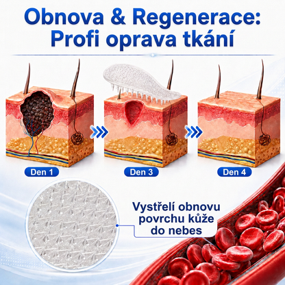 👩‍⚕️🎁Ametlik pood | MURWON®  Mikronõeltega plaastrid täiusliku naha saavutamiseks ja nahavigade eemaldamiseks (nahakasvajate, väikeste nahamoodustiste, tüügaste, sünnimärkide, vanuselaikude ja pigmentatsioonihäirete korral)💡