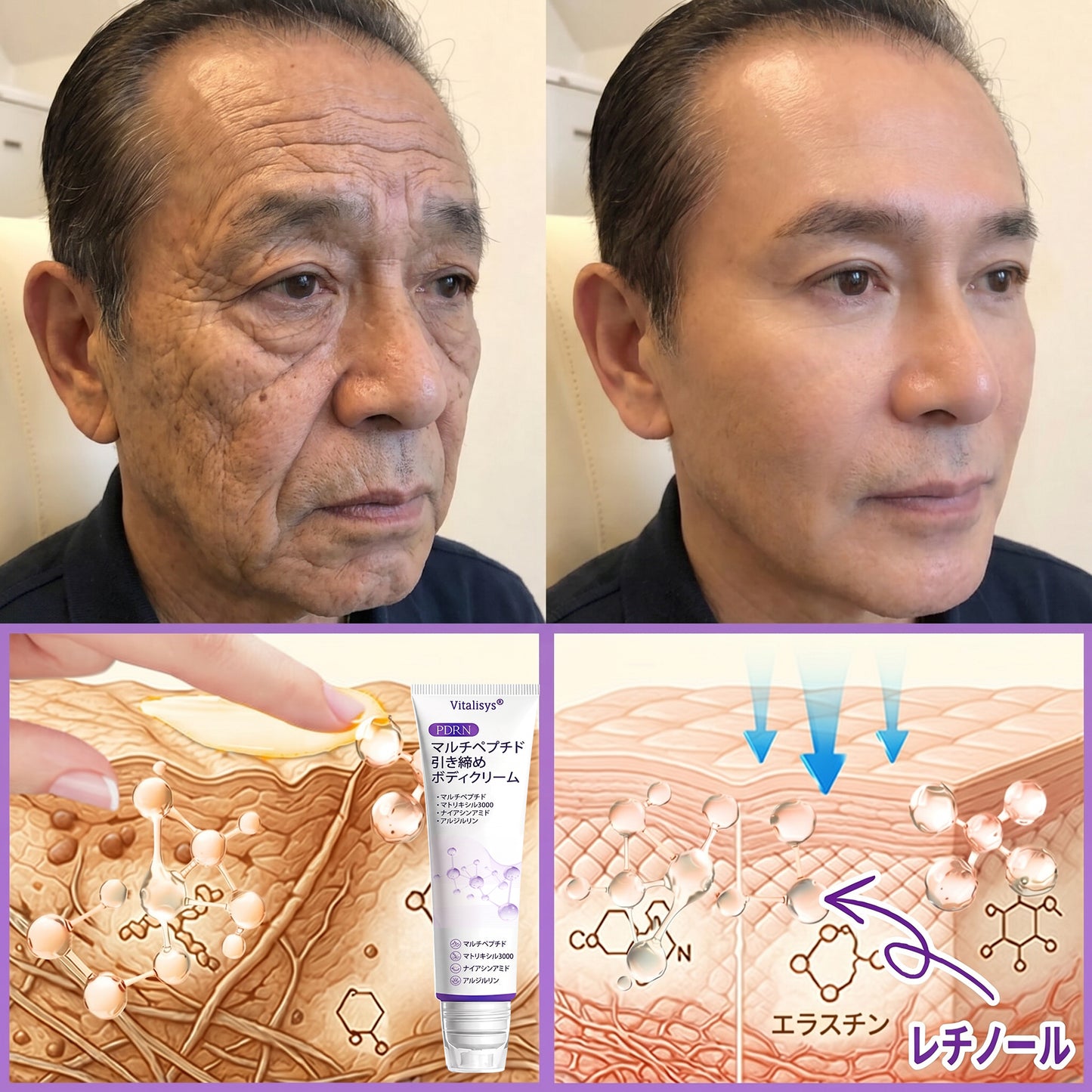 Vitalisys®💎PDRNマルチペプチド マッサージボディローラークリーム — エイジングケア・保湿・肌引き締め＆リフトケア・肌修復・肌トーン均一化・ニキビやシミケア・イボやほくろケア・乾癬による肌トラブルの緩和をサポート —