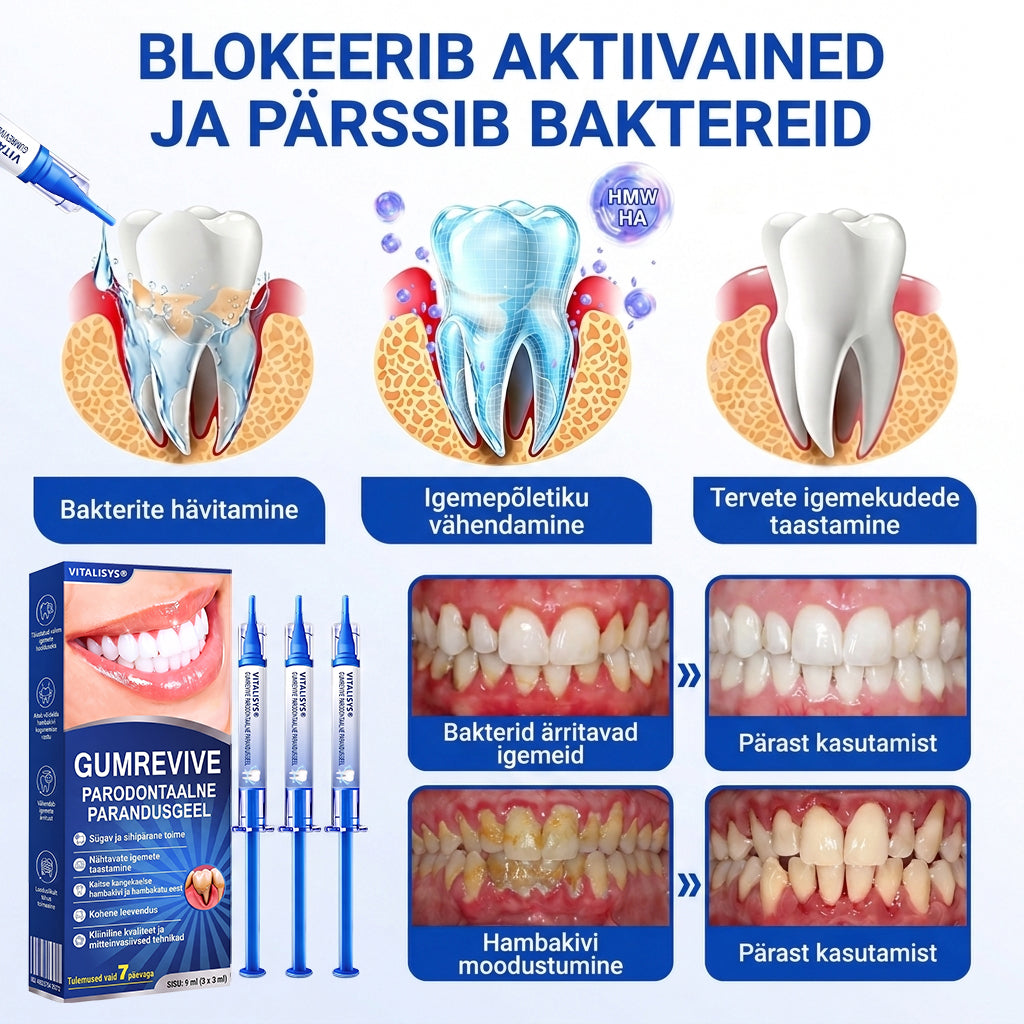 🇪🇪 VITALISYS®🦷 𝑮𝒖𝒎𝑹𝒆𝒗𝒊𝒗𝒆 𝑷𝒂𝒓𝒐𝒅𝒐𝒏𝒕𝒂𝒂𝒍𝒏𝒆 𝒓𝒆𝒈𝒆𝒏𝒆𝒓𝒂𝒕𝒔𝒊𝒐𝒐𝒏𝒊𝒈𝒆𝒆𝒍🍈