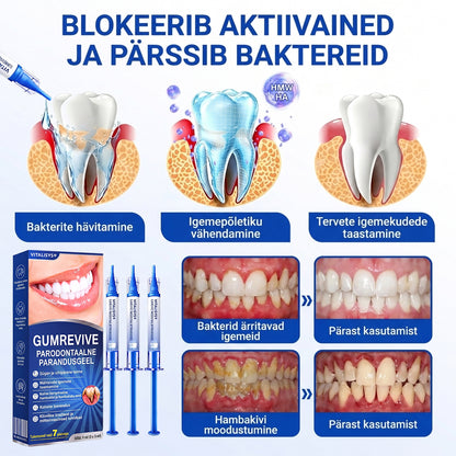 🇪🇪 VITALISYS®🦷 𝑮𝒖𝒎𝑹𝒆𝒗𝒊𝒗𝒆 𝑷𝒂𝒓𝒐𝒅𝒐𝒏𝒕𝒂𝒂𝒍𝒏𝒆 𝒓𝒆𝒈𝒆𝒏𝒆𝒓𝒂𝒕𝒔𝒊𝒐𝒐𝒏𝒊𝒈𝒆𝒆𝒍🍈