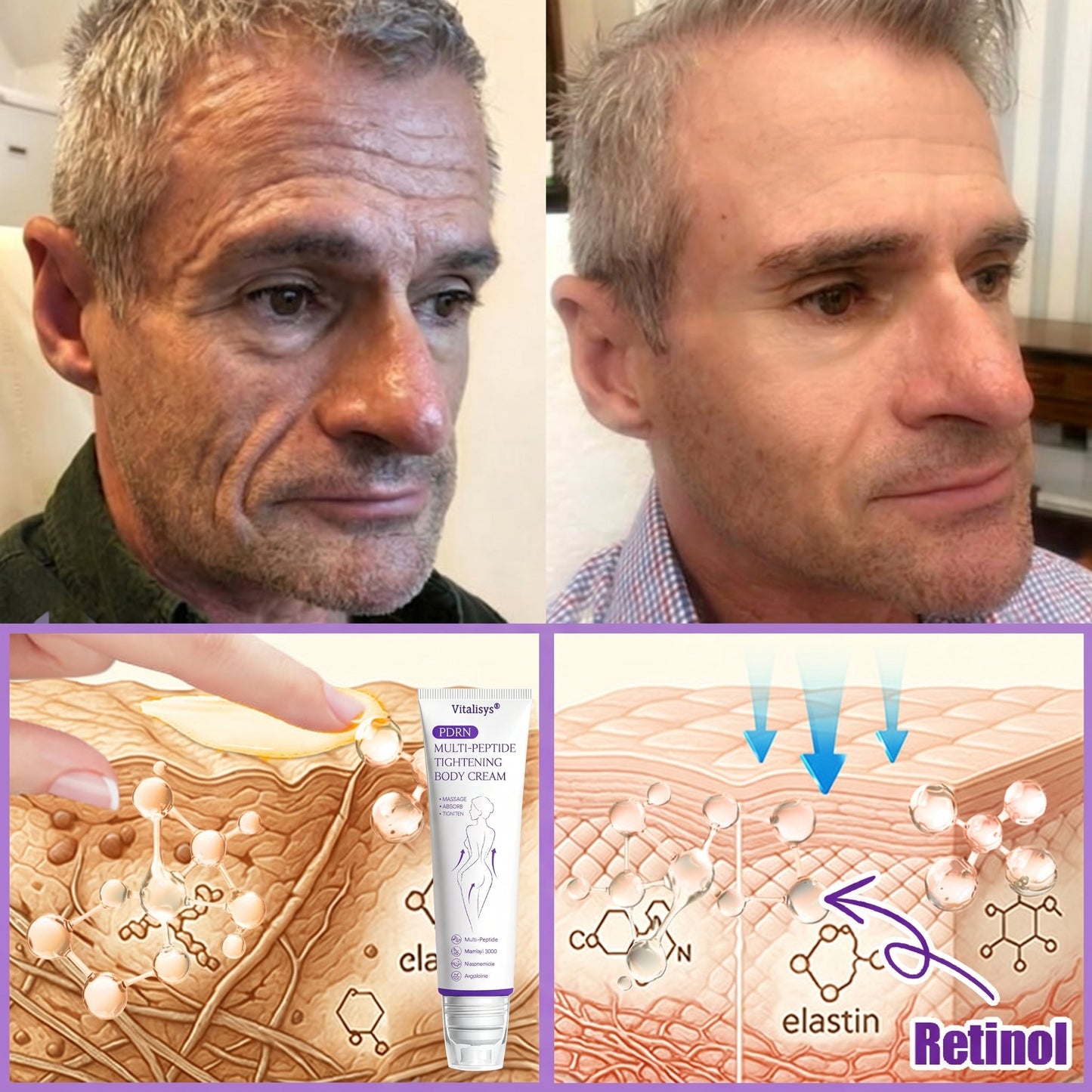 💎Vitalisys® PDRN Multi-Peptide Massaging Body Roller Cream- Anti-aging, Hydrating, Skin Firming & Lifting, Skin Repair, Even Tone, Acne and Dark Spot Treatment, Wart and Mole Removal, and Psoriasis Relief.